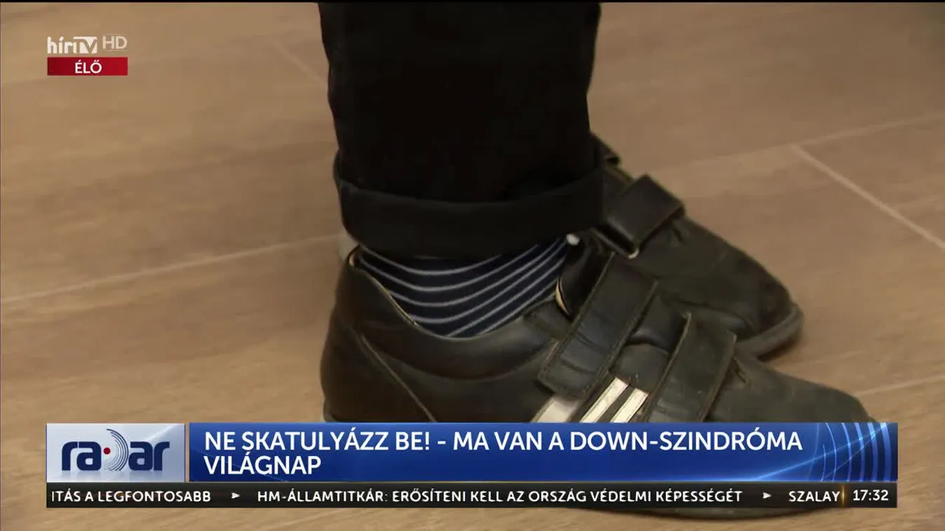 Ne skatulyázz be! - Ma van a Down-szindróma világnap