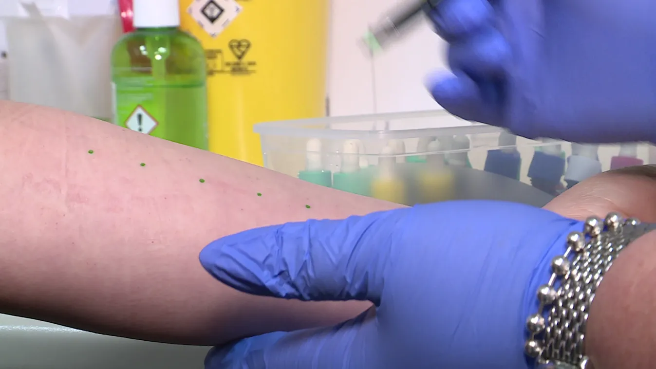 Idén szokatlanul korán kezdődött az allergiaszezon + videó