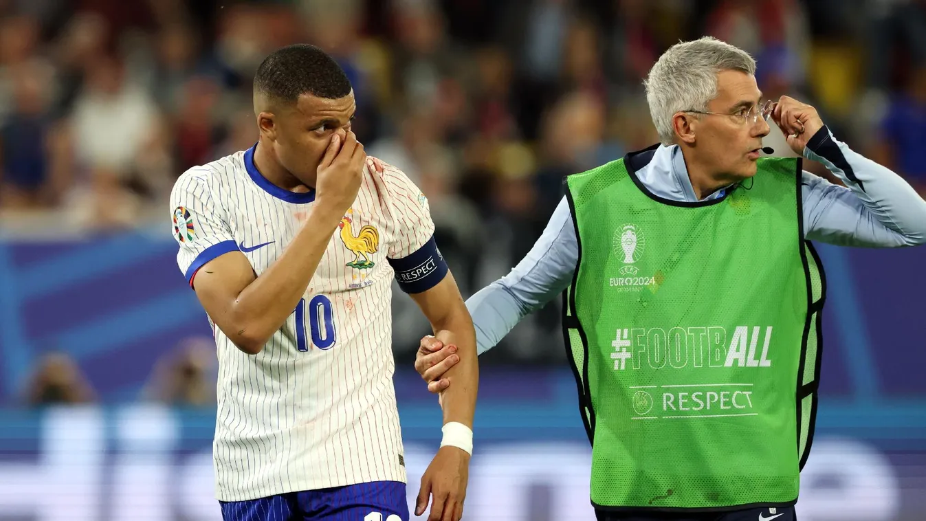 Eltört Kylian Mbappé orra