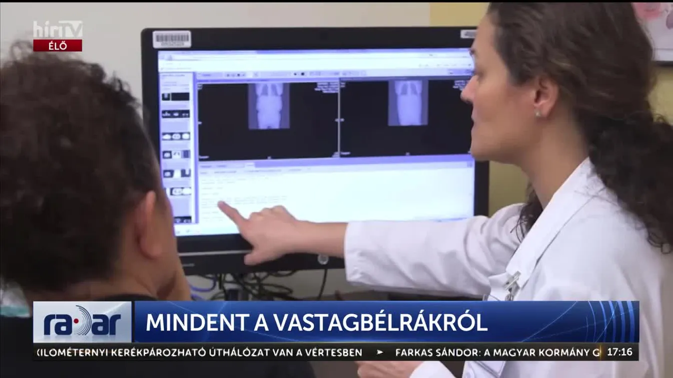 Radar - Mindent a vastagbélrákról