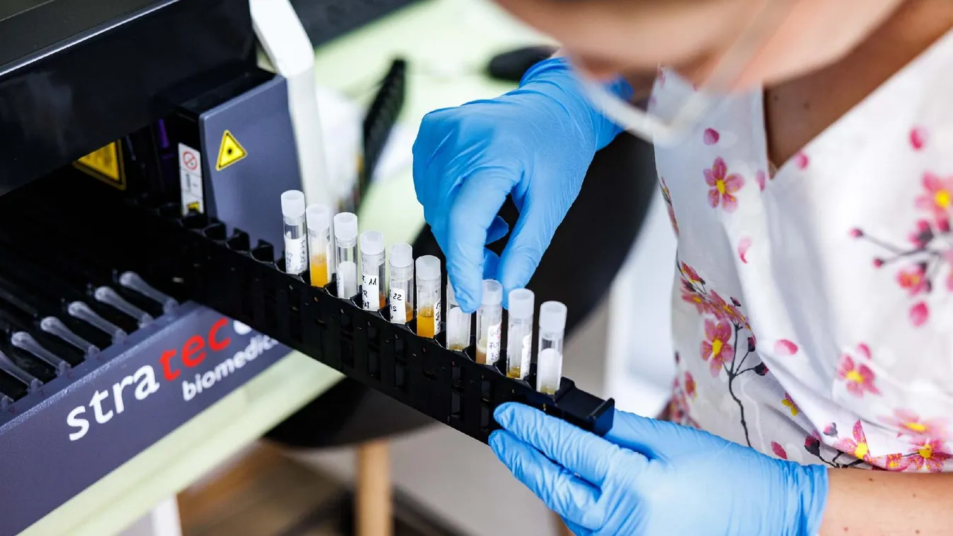 Forradalmi áttörés az Alzheimer-kór korai felismerésében