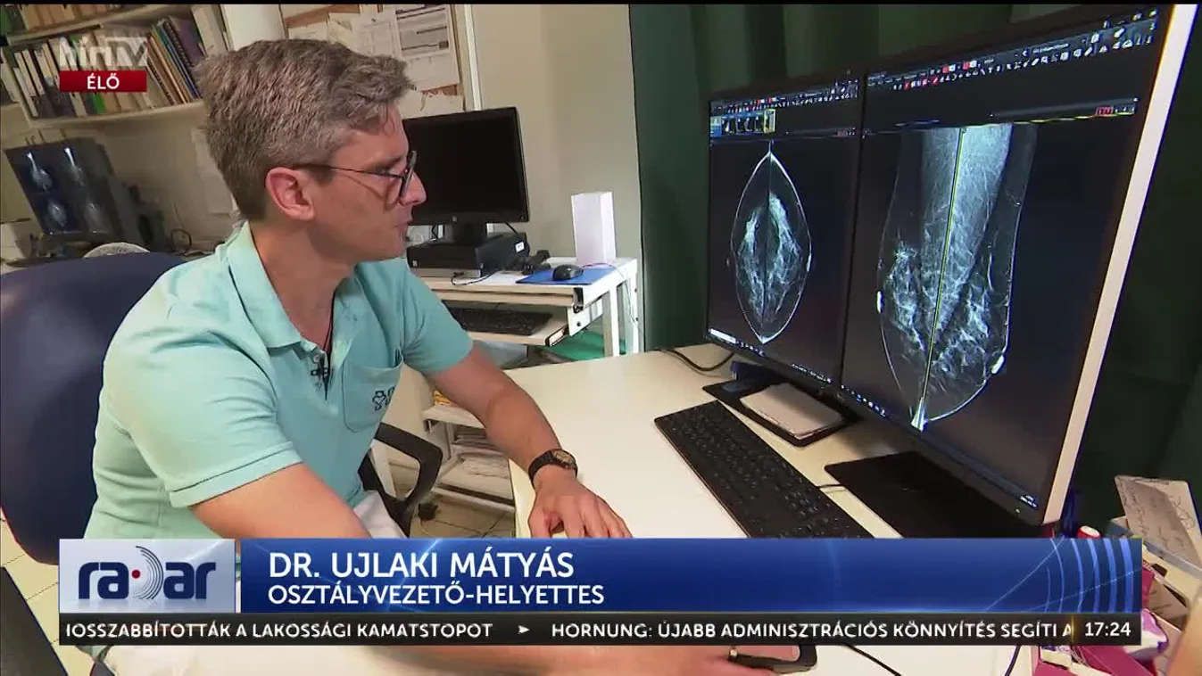 Radar - Mellrák - a többség nem él a szűrés lehetőségével