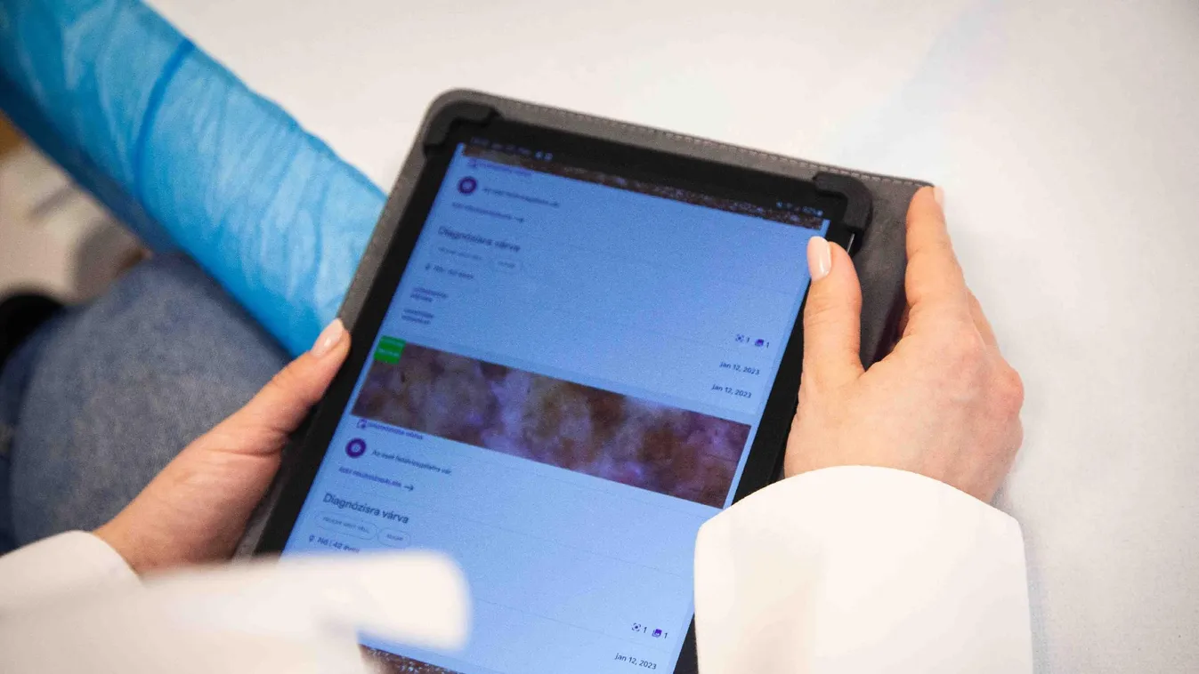 Milliárdokat spórolhat Magyarország egy egészségügyi fejlesztéssel