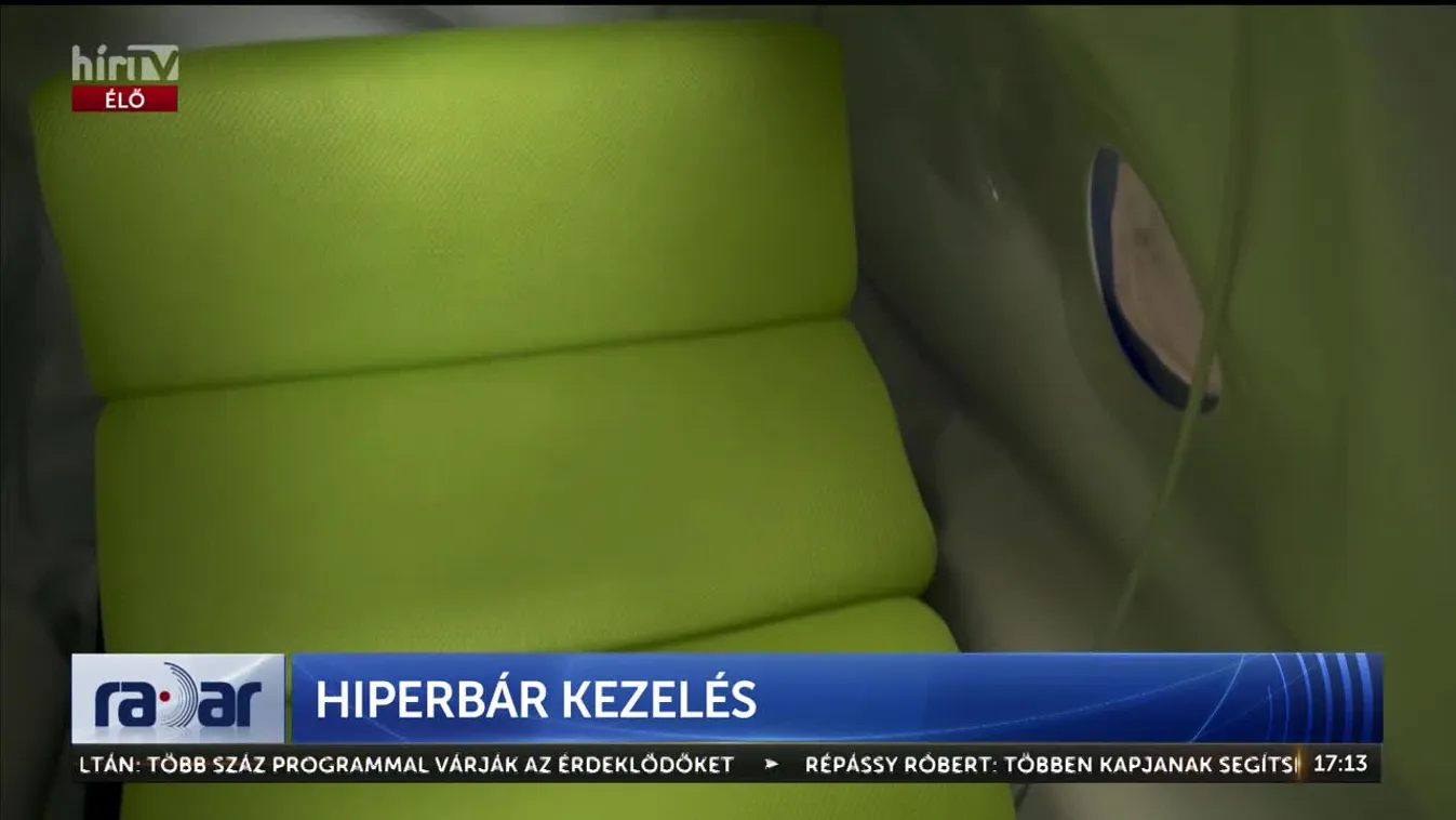 RADAR - HIPERBÁR KEZELÉS