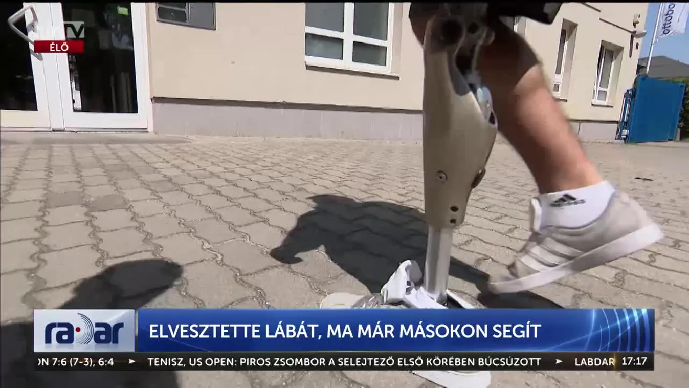 Radar - Elvesztette lábát, ma már másokon segít (2024-08-21)