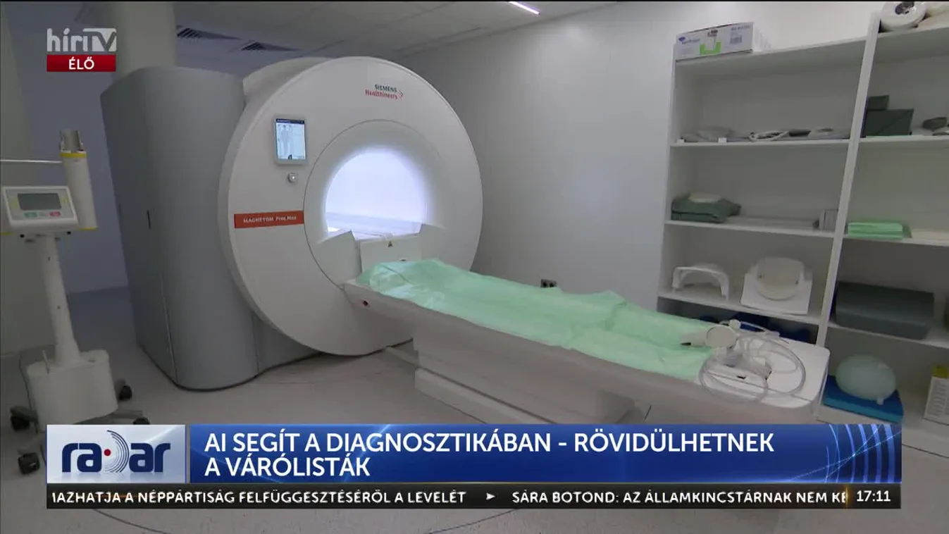 Radar - AI segít a diagnosztikában - rövidülhetnek a várólisták