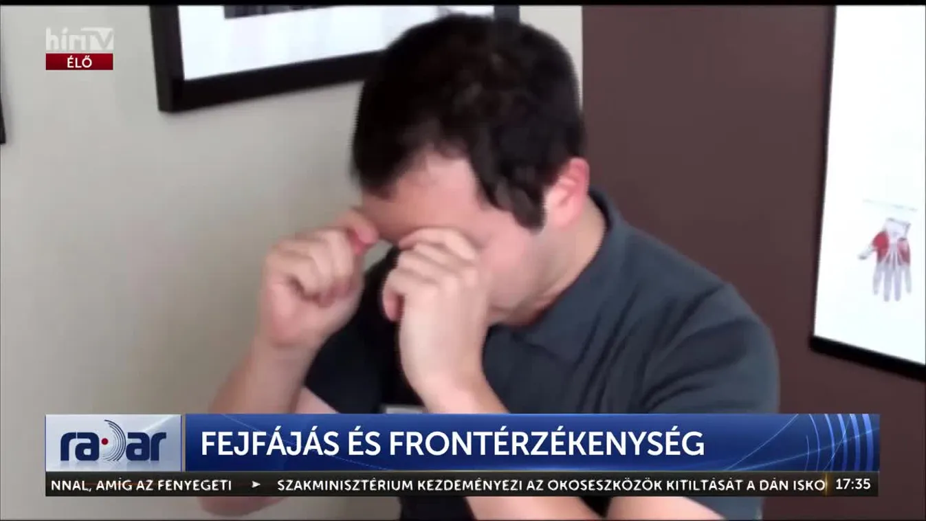 Radar- FEJFÁJÁS ÉS FRONTÉRZÉKENYSÉG