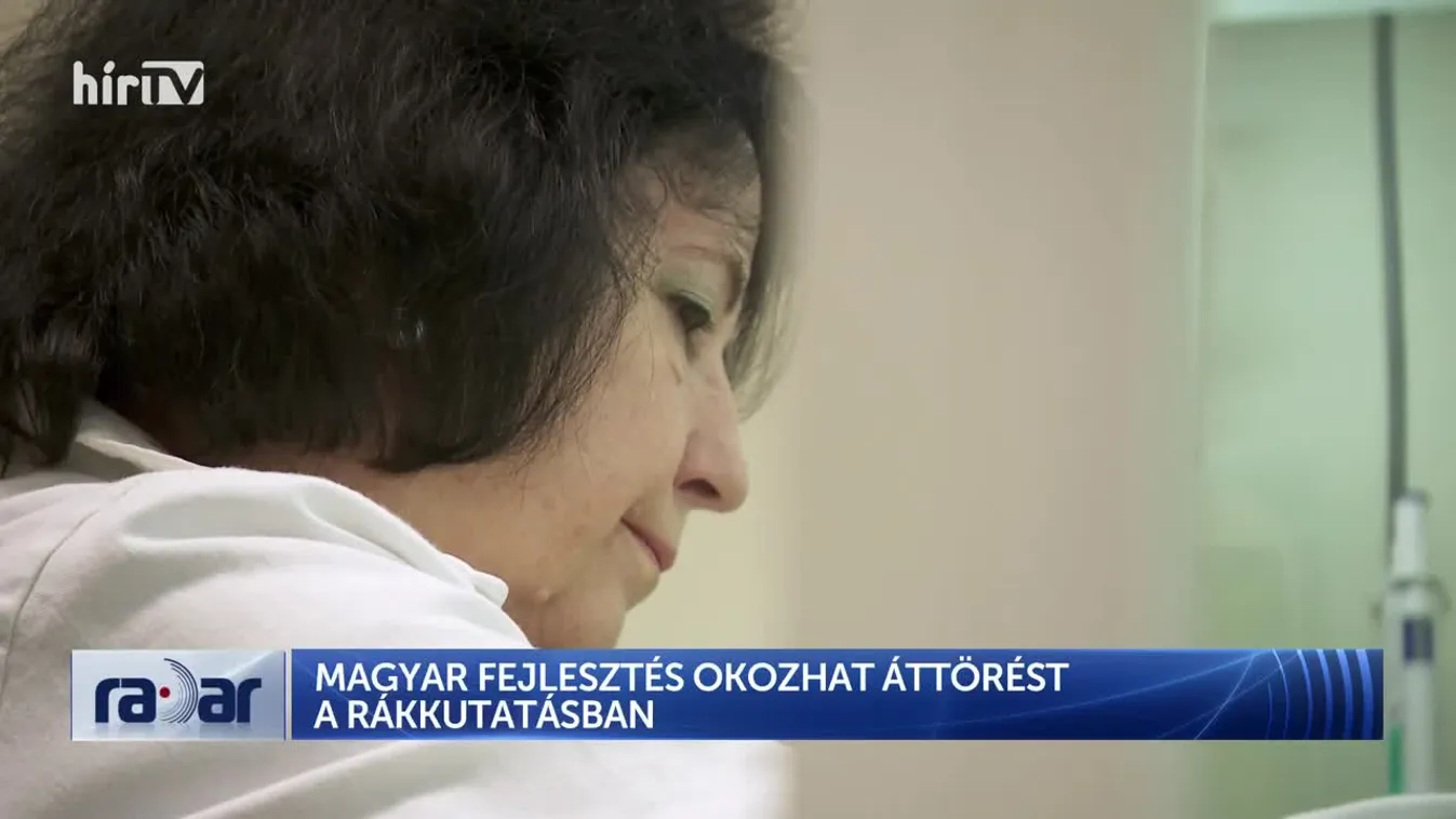 Radar - Magyar fejlesztés okozhat áttörést a rákkutatásban