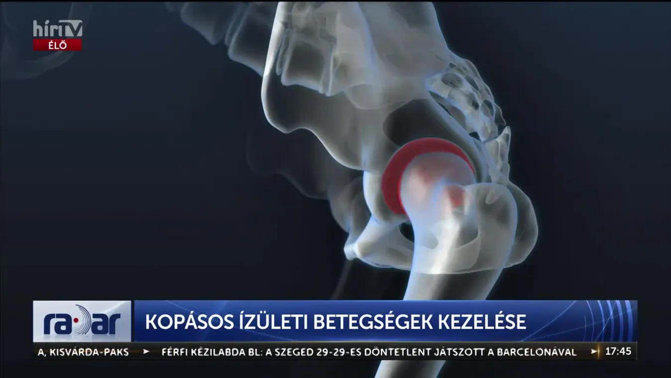 Radar – Kopásos ízületi betegségek kezelése