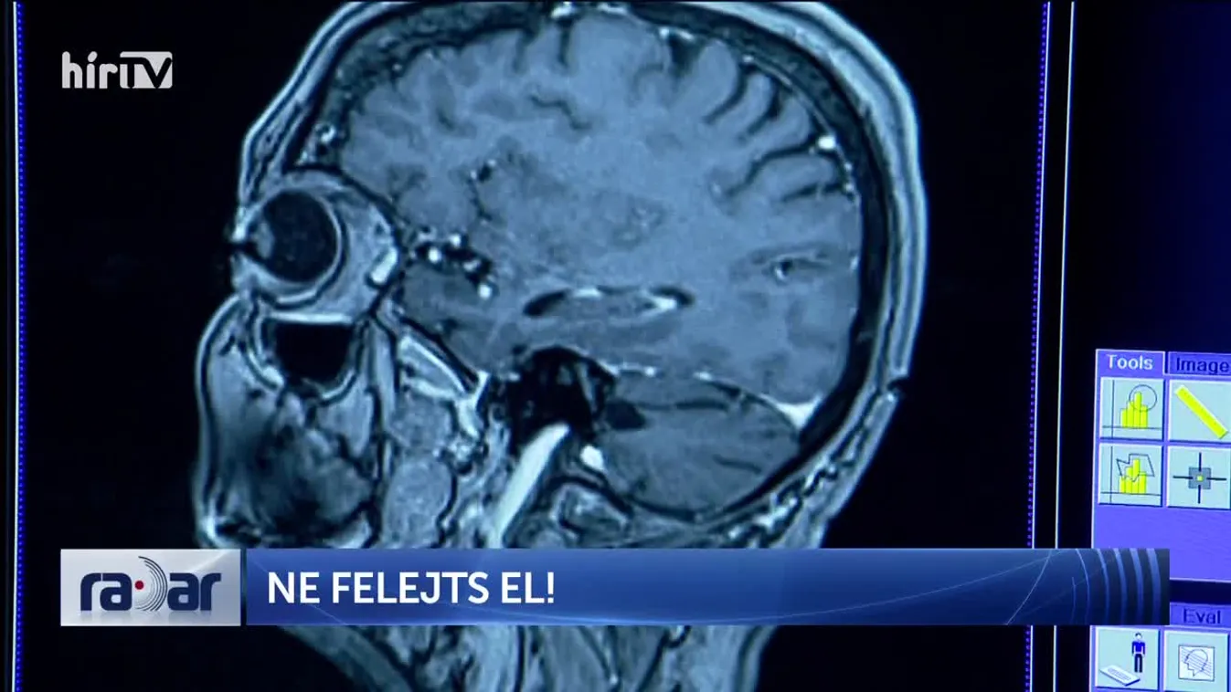 Radar - NE FELEJTS EL!