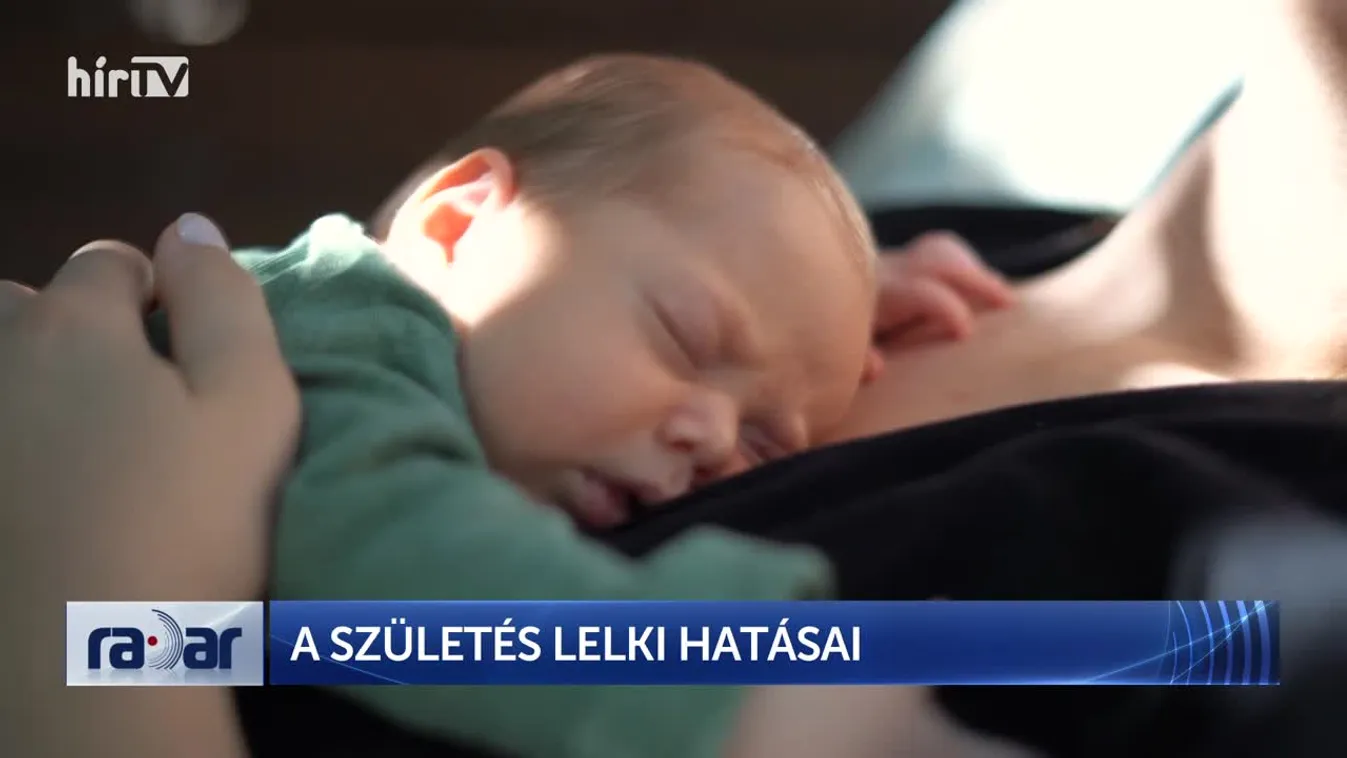 Radar - Babaterápia