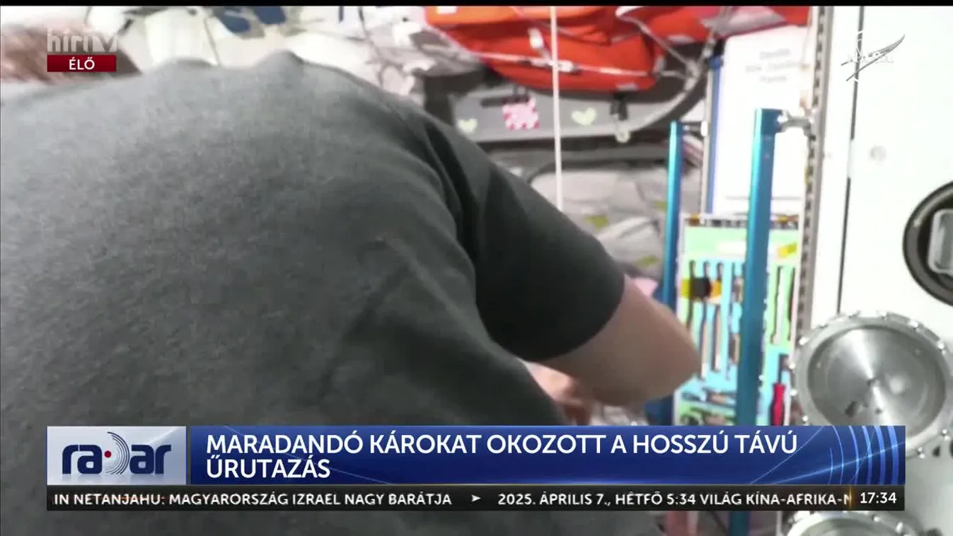 Radar – Maradandó károkat okozott a hosszú távú űrutazás