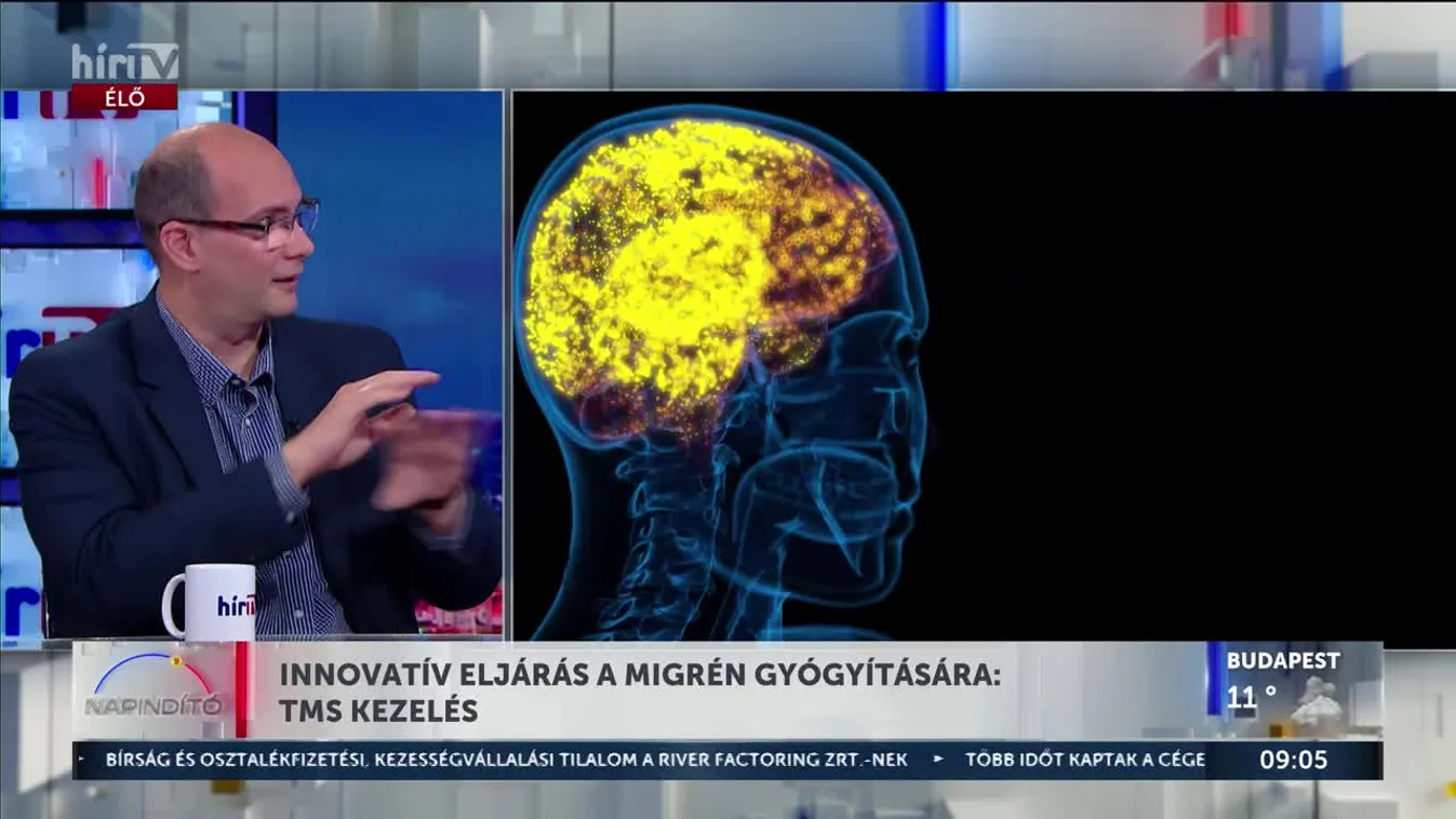 Innovatív eljárás a migrén gyógyítására: TMS kezelés