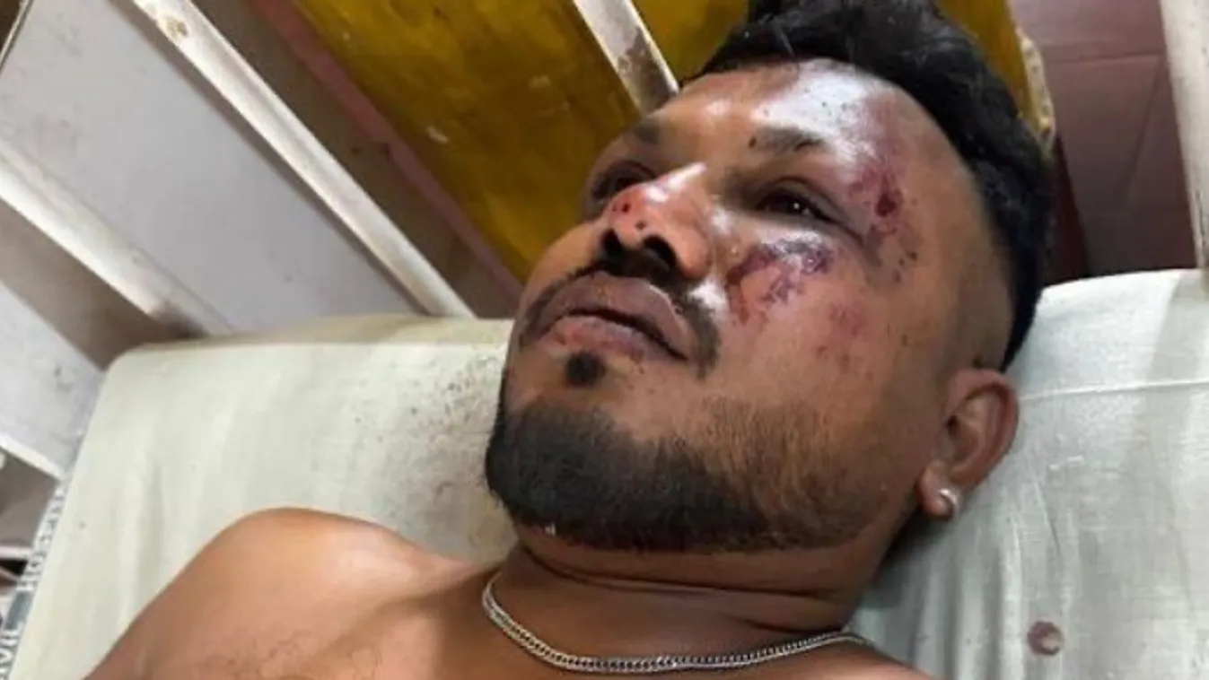 BBC: Mégis van egy túlélője az indiai légikatasztrófának