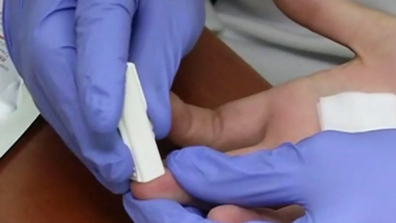 Ukrajna csatlakozása közegészségügyi lavinát indíthat el Európában  + videó