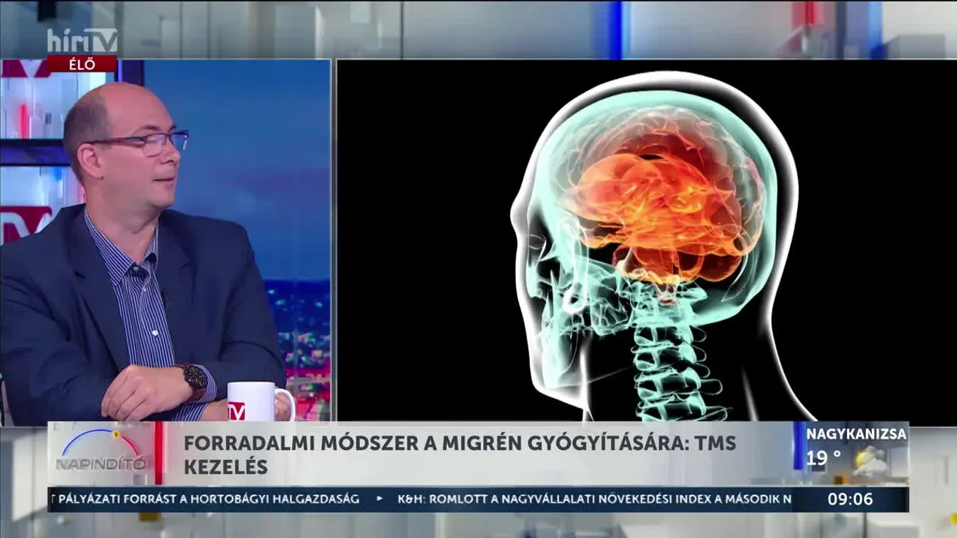 Forradalmi módszer a migrén kezelésére: TMS-kezelés