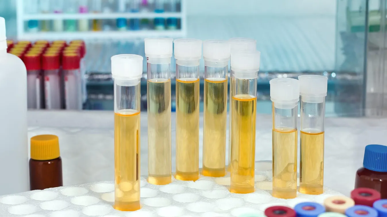 Kína korlátozza az Európai Unióból származó orvostechnikai eszközök behozatalát