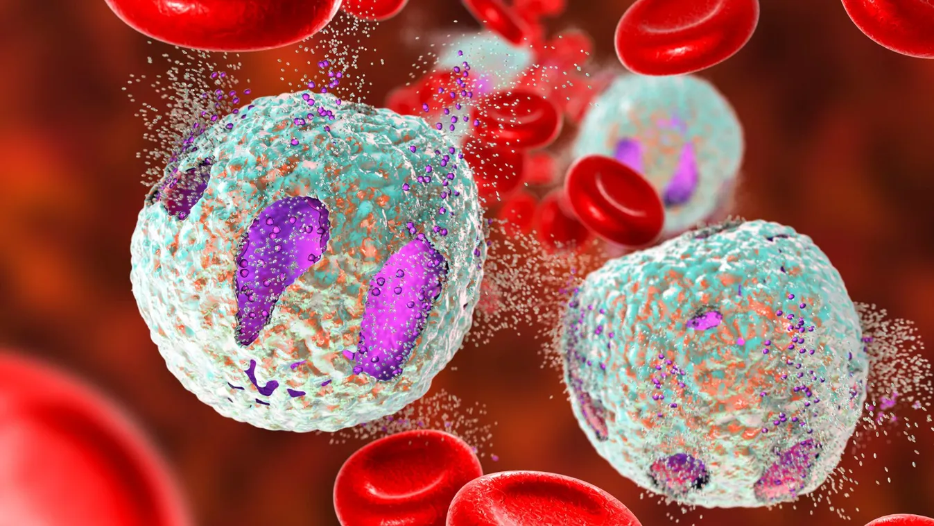 Az ALS kialakulásának hátterét vizsgálták szegedi kutatók