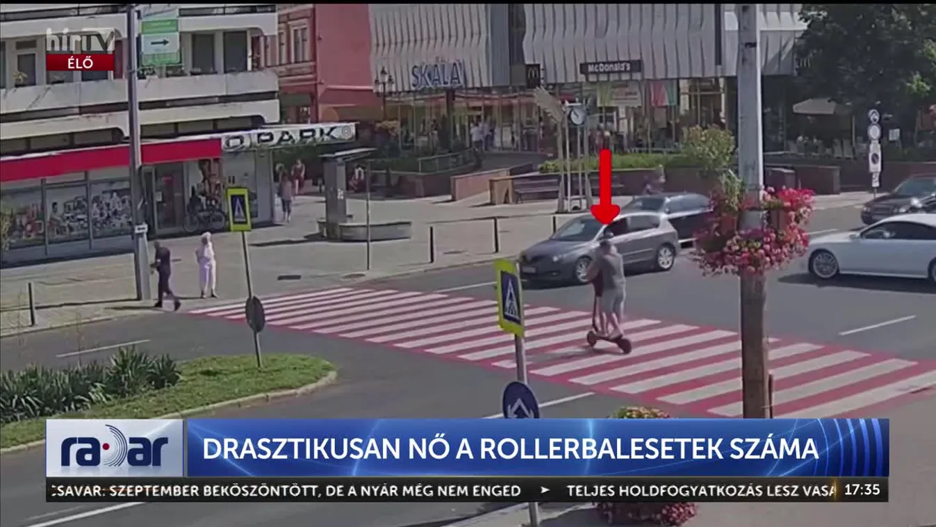 	Radar - Drasztikusan nő a rollerbalesetek száma