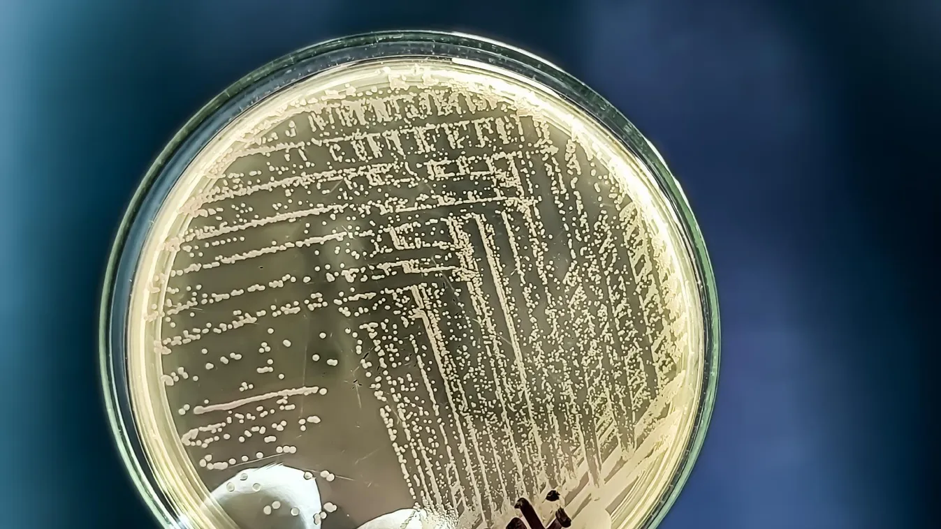 Szörnyű kór szedi áldozatait Belgiumban