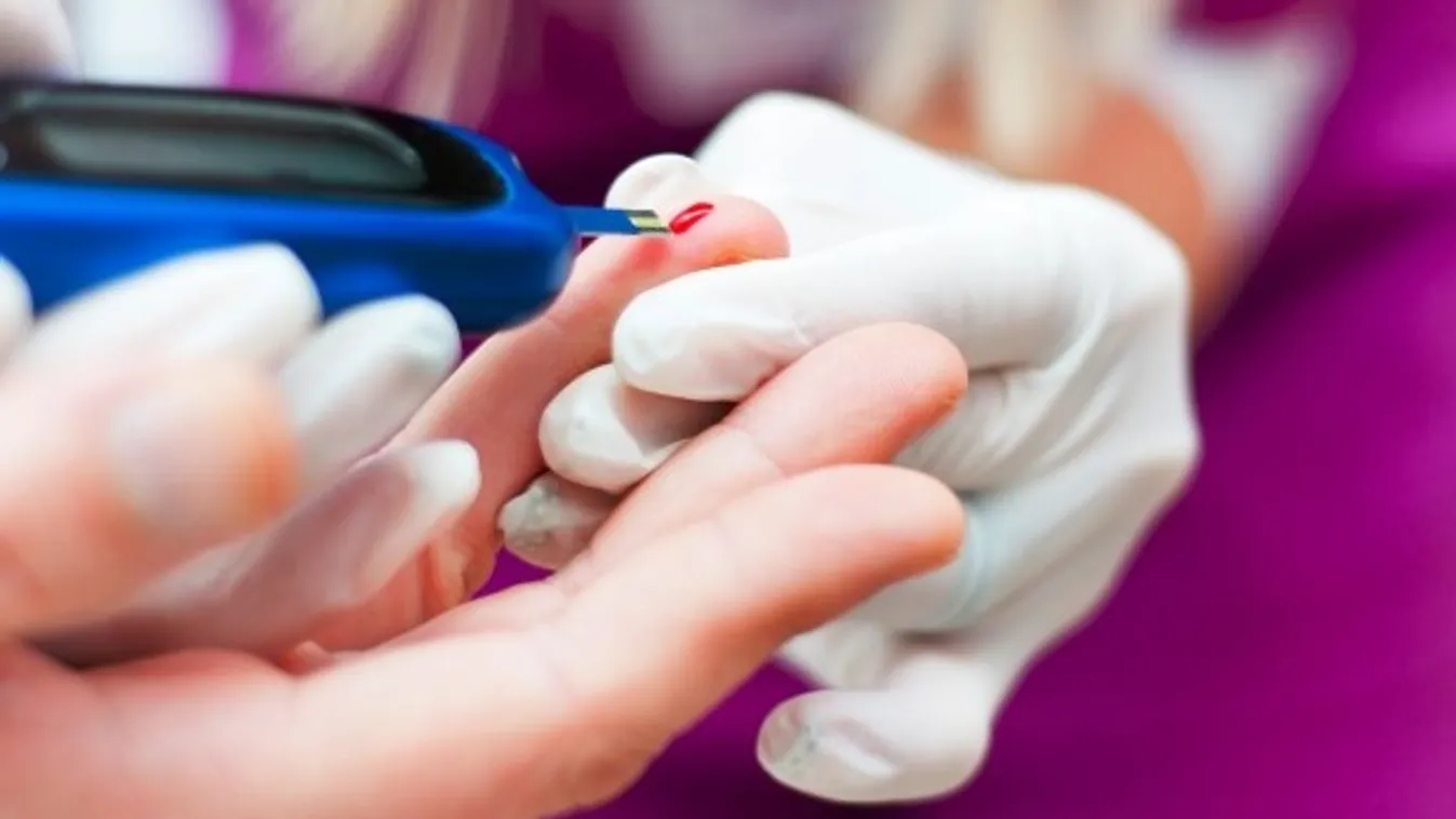 A cukorbetegek sebgyógyulását segítő készítményt fejlesztettek ki Szegeden