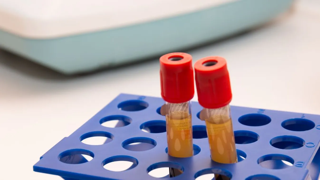 Vérplazma adására kérik a gyógyultakat