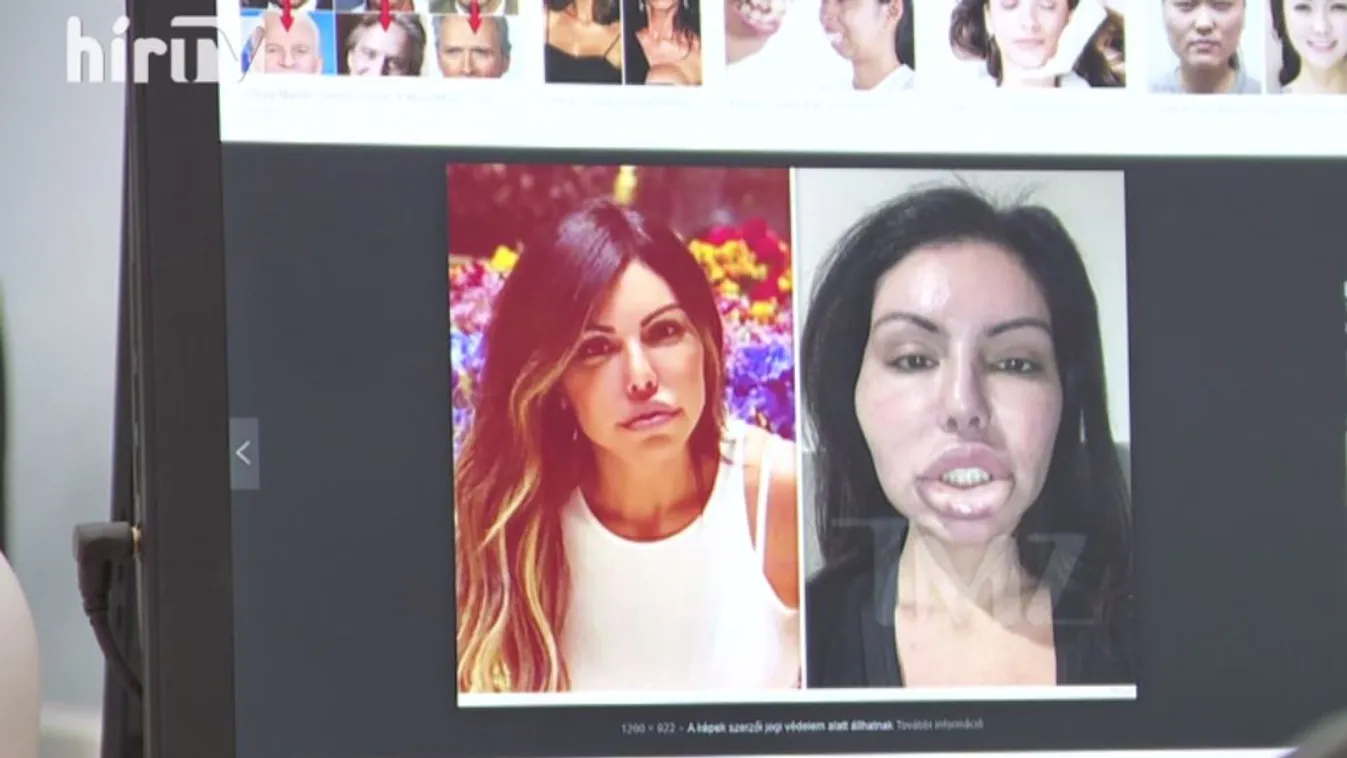 Panaszkönyv: Méregdrága szépészeti beavatkozások ijesztő eredményekkel