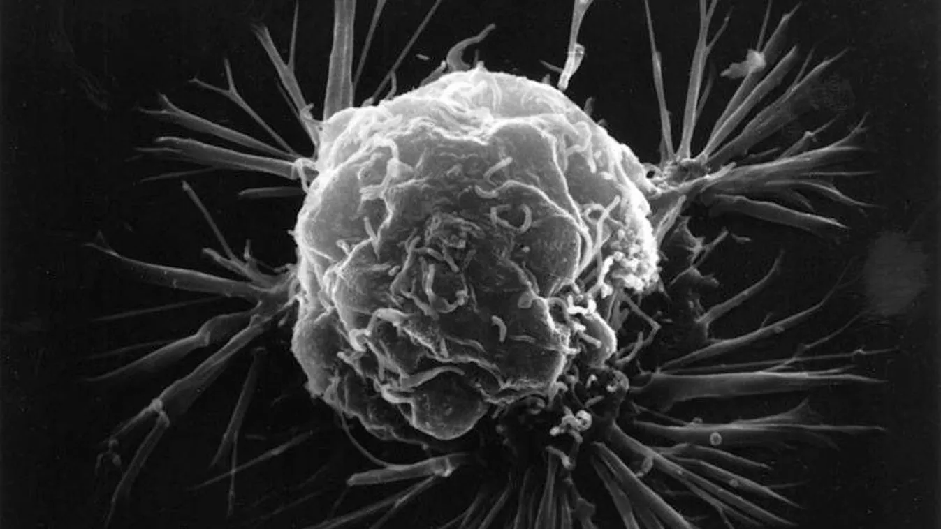 Forradalom jöhet a rák gyógyításában