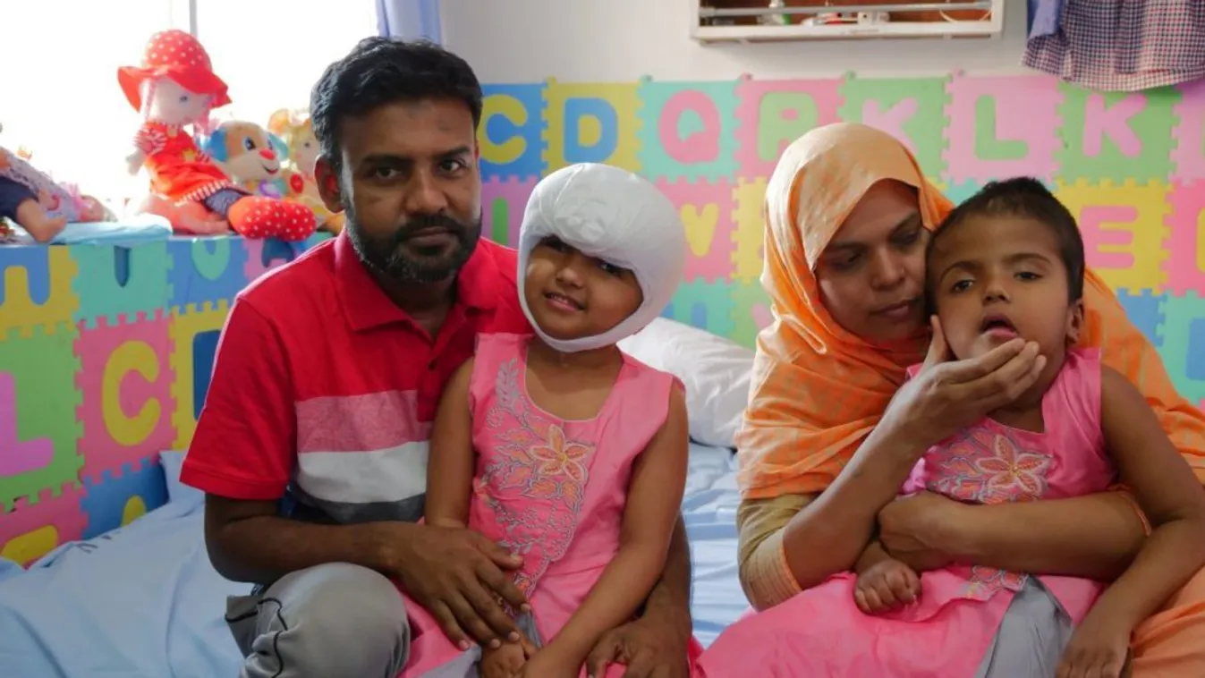 Hazatértek és felveszik a harcot a koronavírussal a bangladesi sziámi ikreken segítő magyar orvosok