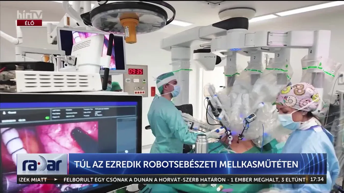 Radar - TÚL AZ EZREDIK ROBOTSEBÉSZETI MELLKASMŰTÉTEN