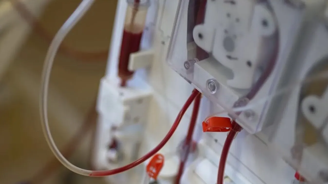 Radar – Minden tizedik ember vesebeteg   + videó