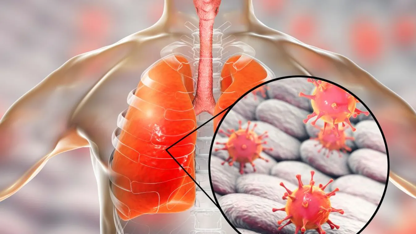 Újabb városokban bukkant fel az új, tüdőgyulladás-vírus Kínában
