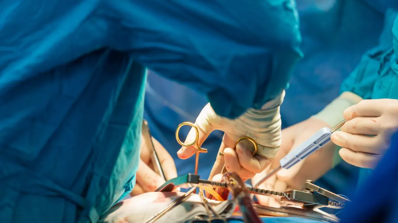 Tavaly 320 szervátültetést végeztek Magyarországon