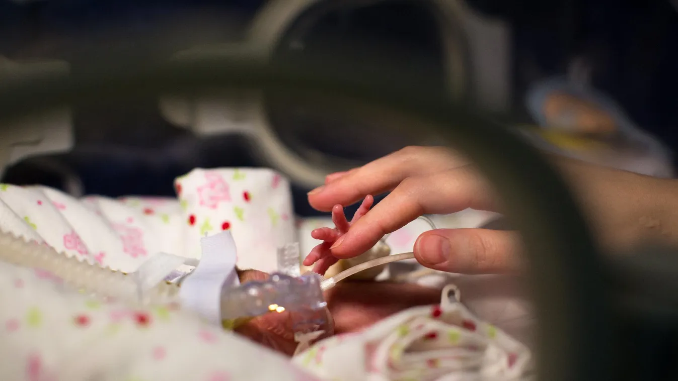 Egy kanadai ikerpár megdöntötte a koraszülött ikrek világrekordját