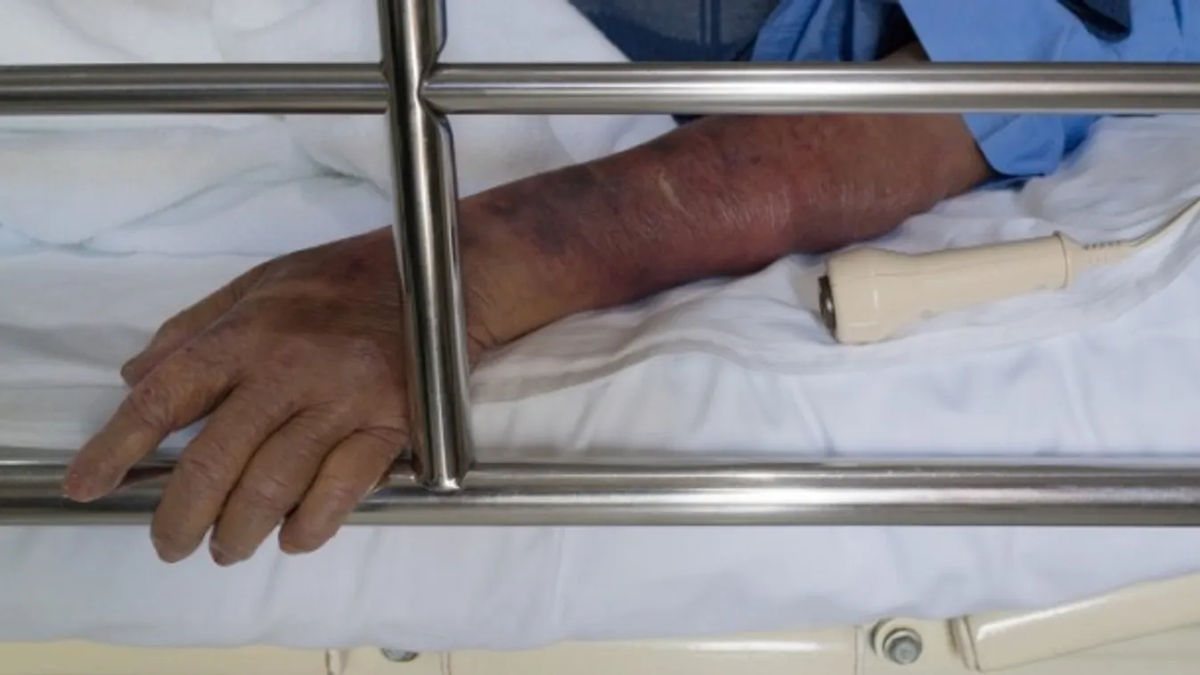 Kórházi reality – Látótér