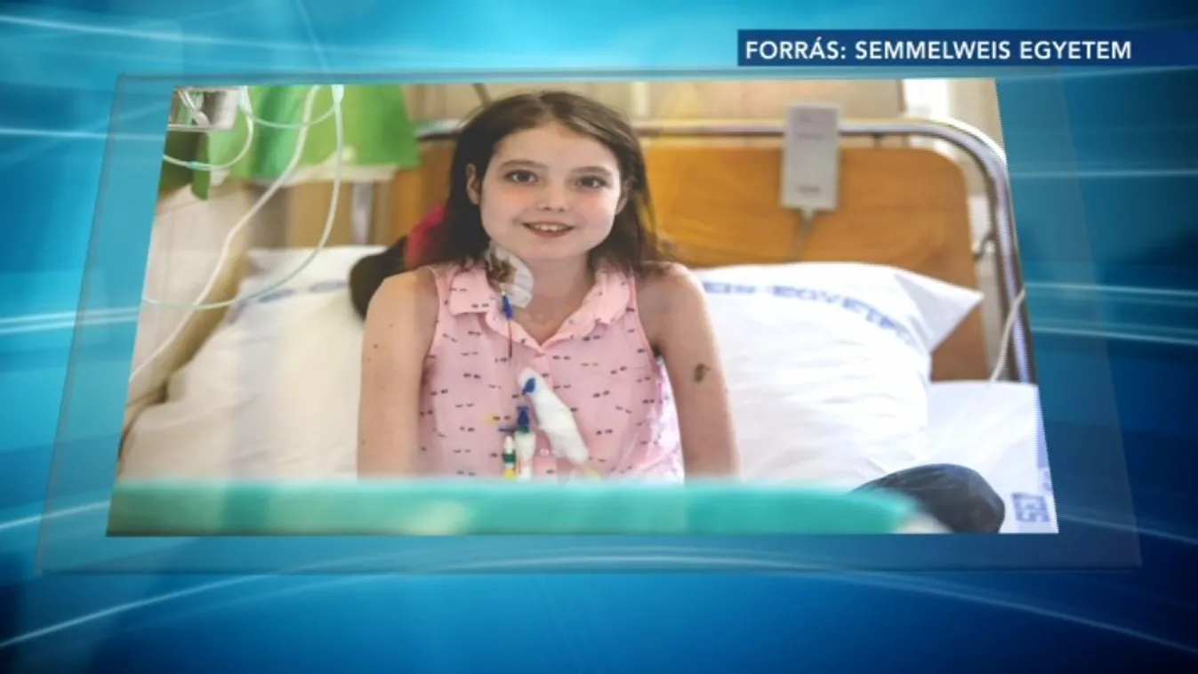 Megtörtént az első gyermek tüdőátültetés Magyarországon