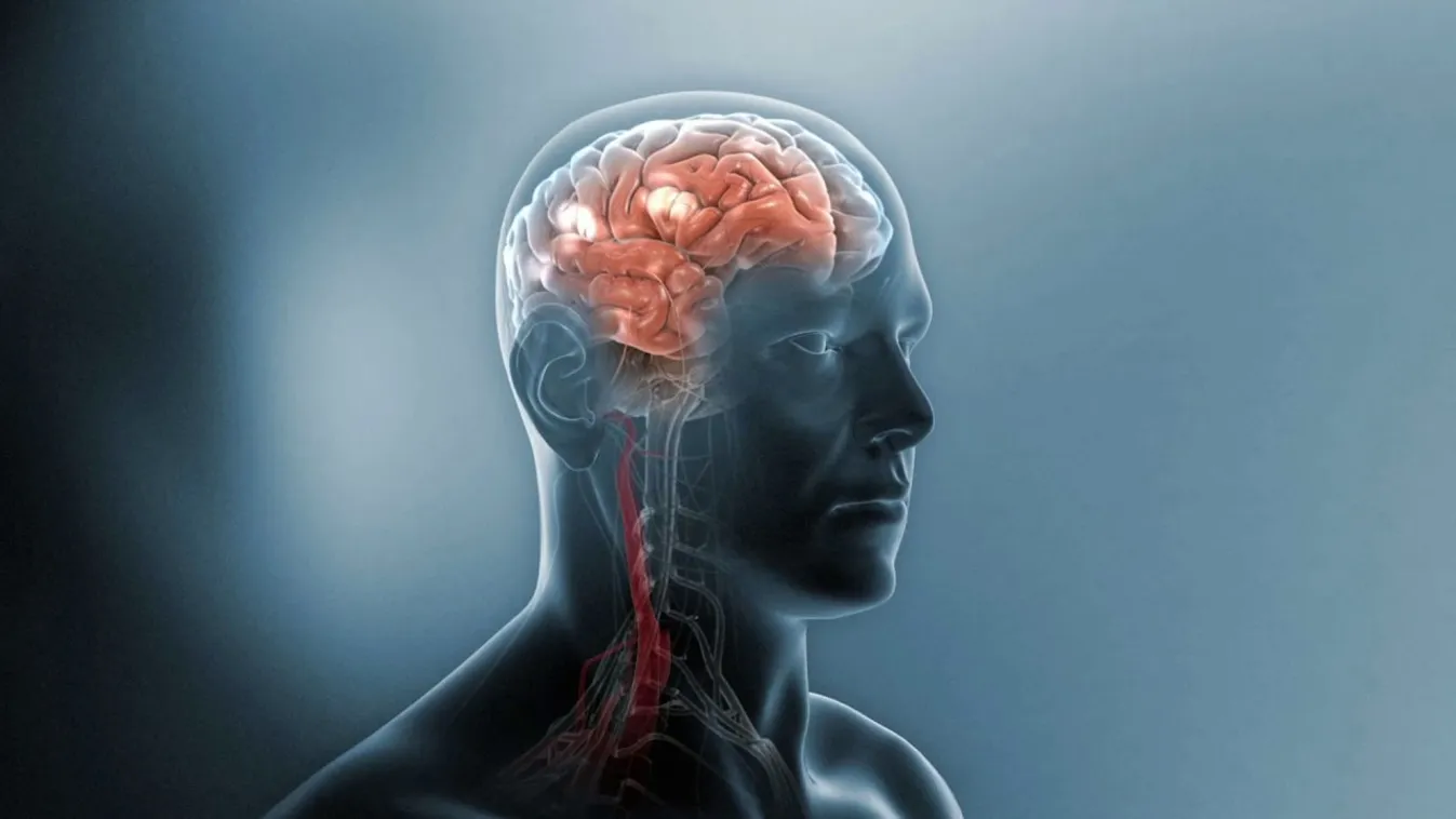 Sikerült lassítani az SM-betegség súlyosbodását