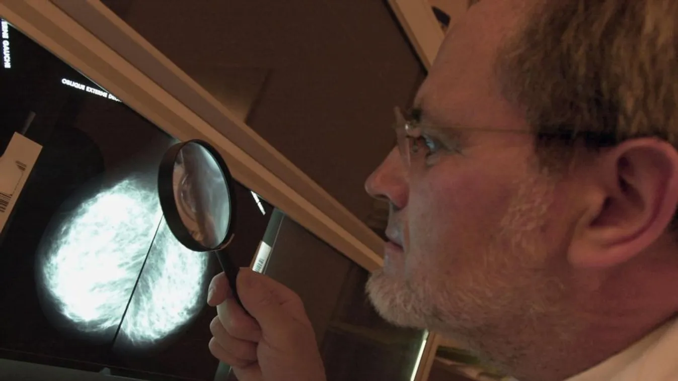 Mellrák a férfiaknál – Reggeli járat