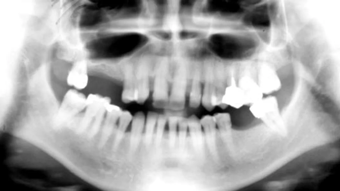 Fogorvossztrájk – Newsroom