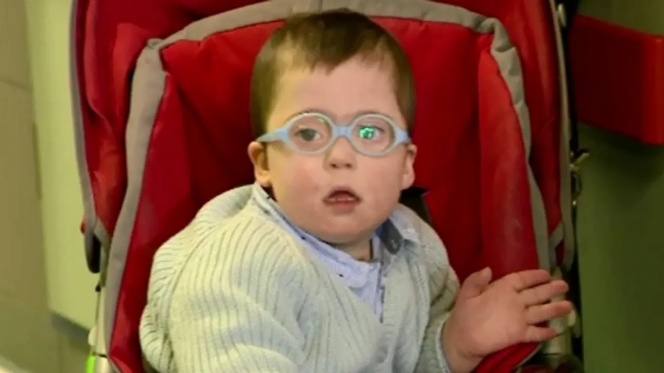 A Down-szindrómával született gyerekek mára minden esetben átesnek a szükséges műtéten