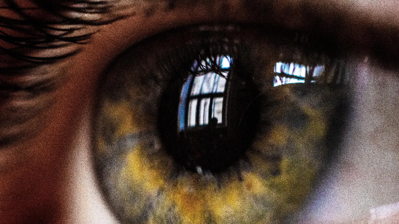 Lézeres szemhéjplasztika: precíz gyors biztonságos megoldás a látáskomfort javulásáért