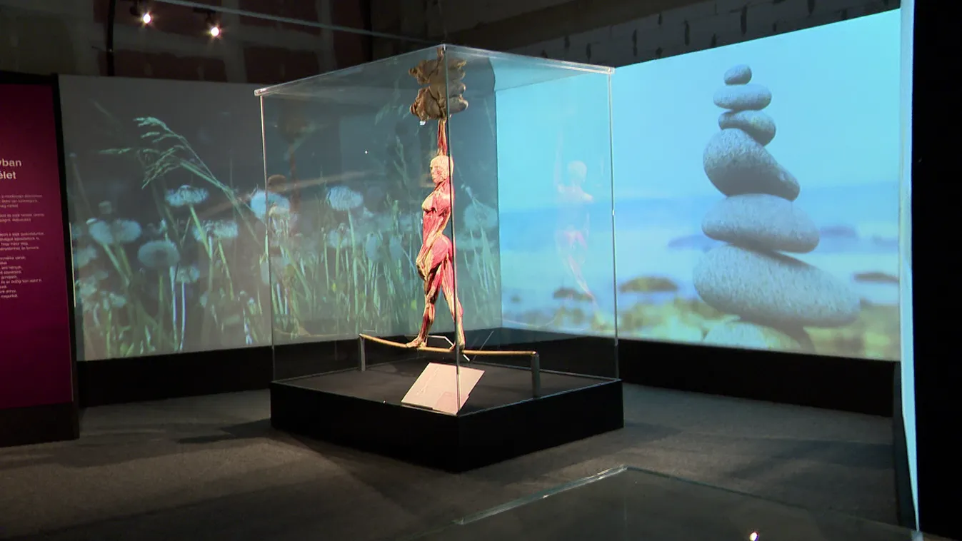 Radar - Preparált testek Budapesten