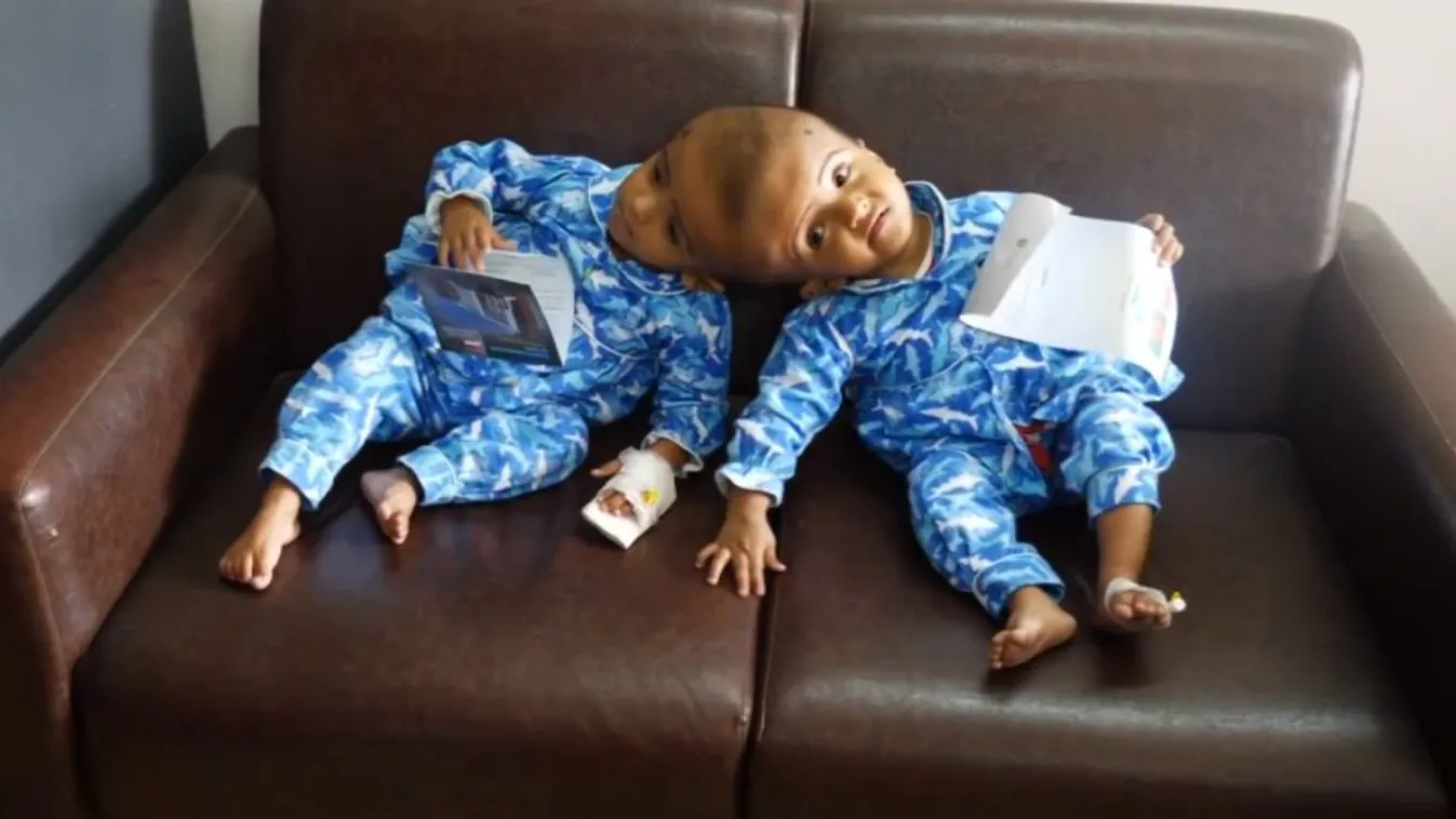 Világraszóló magyar siker egy különleges eljárással