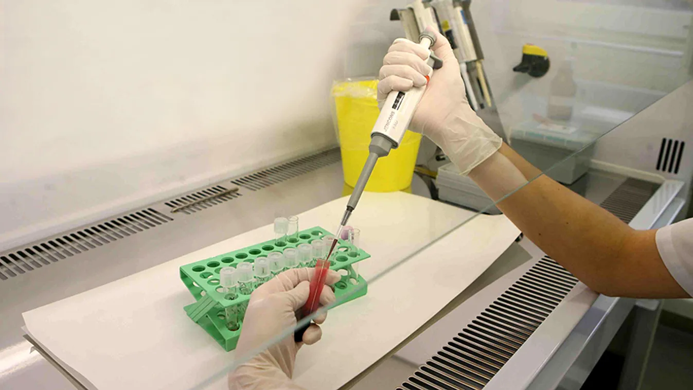 Folyamatosan nő a HIV-fertőzöttek száma hazánkban