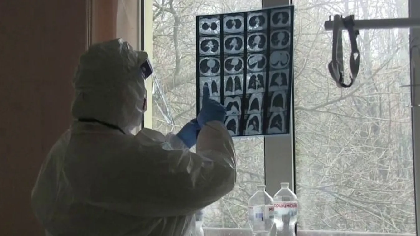 6819-cel emelkedett a beazonosított fertőzöttek száma és elhunyt 156 beteg