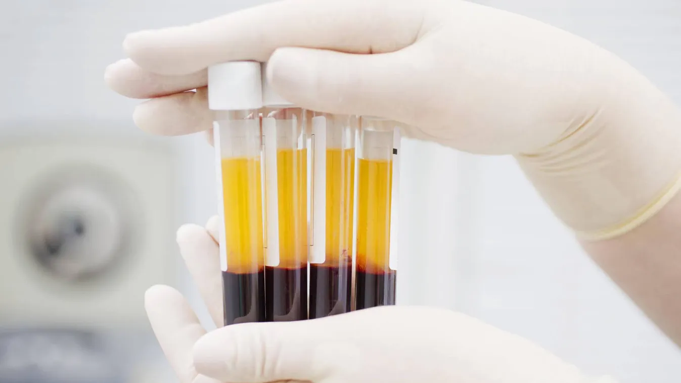 Vérplazmaadásra várja a fertőzésen átesett hallgatóit és dolgozóit a Semmelweis Egyetem