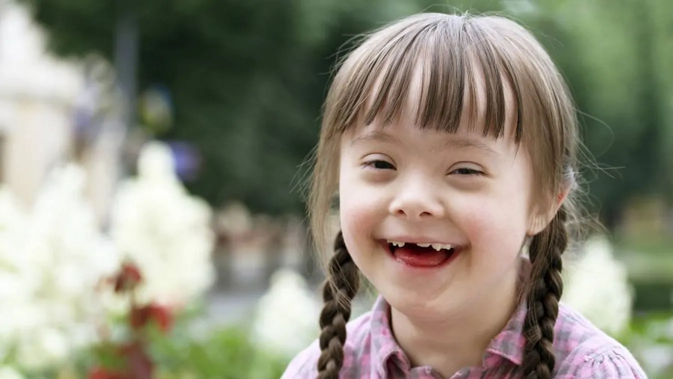 Március 21. a Down-szindrómások világnapja