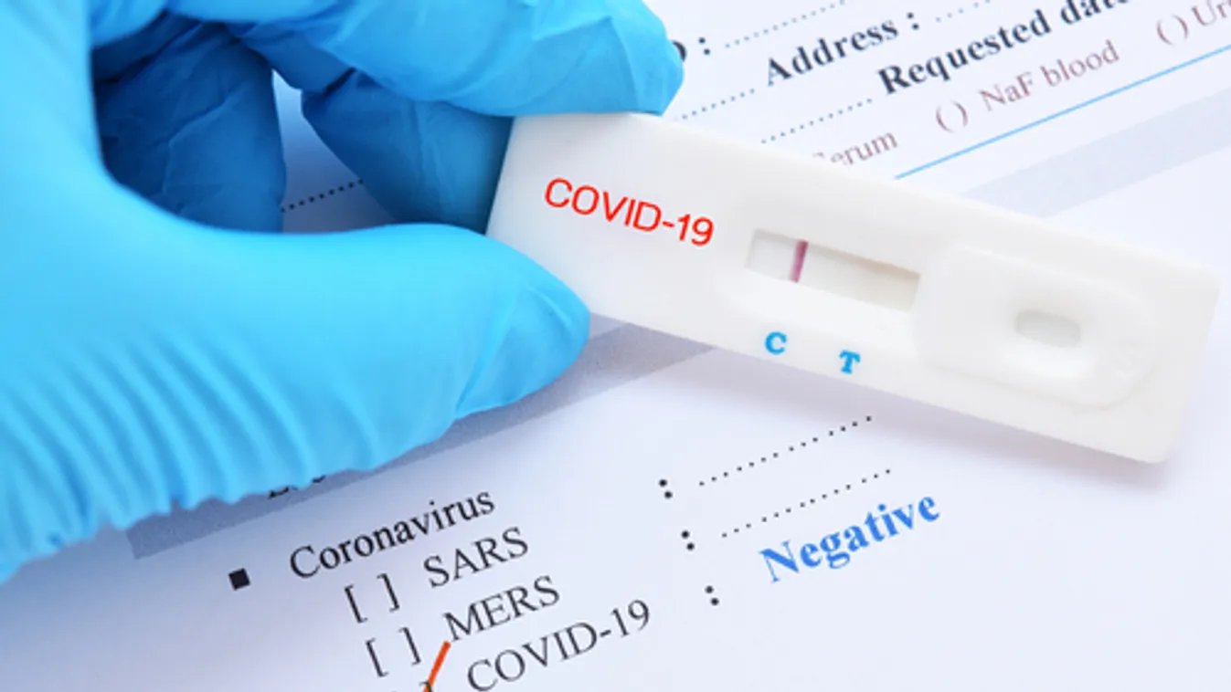 Szlovákiában már negatív teszttel is igénybe vehetők a szállodai szolgáltatások