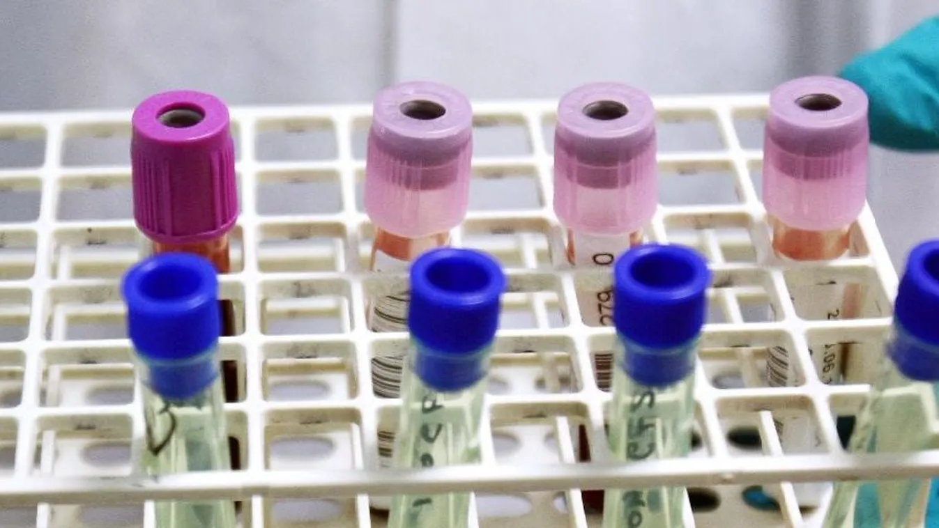 Élesedik a harc a doppinghasználat ellen