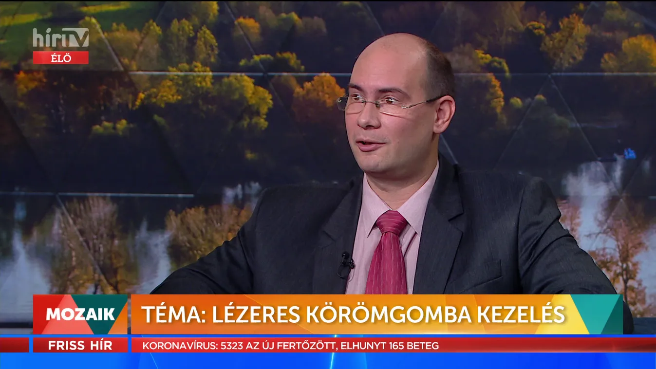 Mozaik: Lézeres körömgomba kezelés